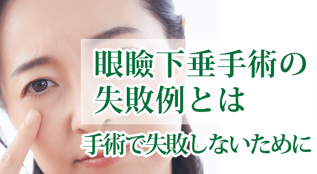 眼瞼下垂手術の失敗例とは、眼瞼下垂の手術で失敗しないため